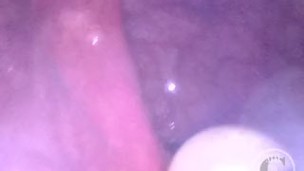 CAM INSIDE ASS: The Balls disappeared deep inside my hole ⚽⛓ – Preview